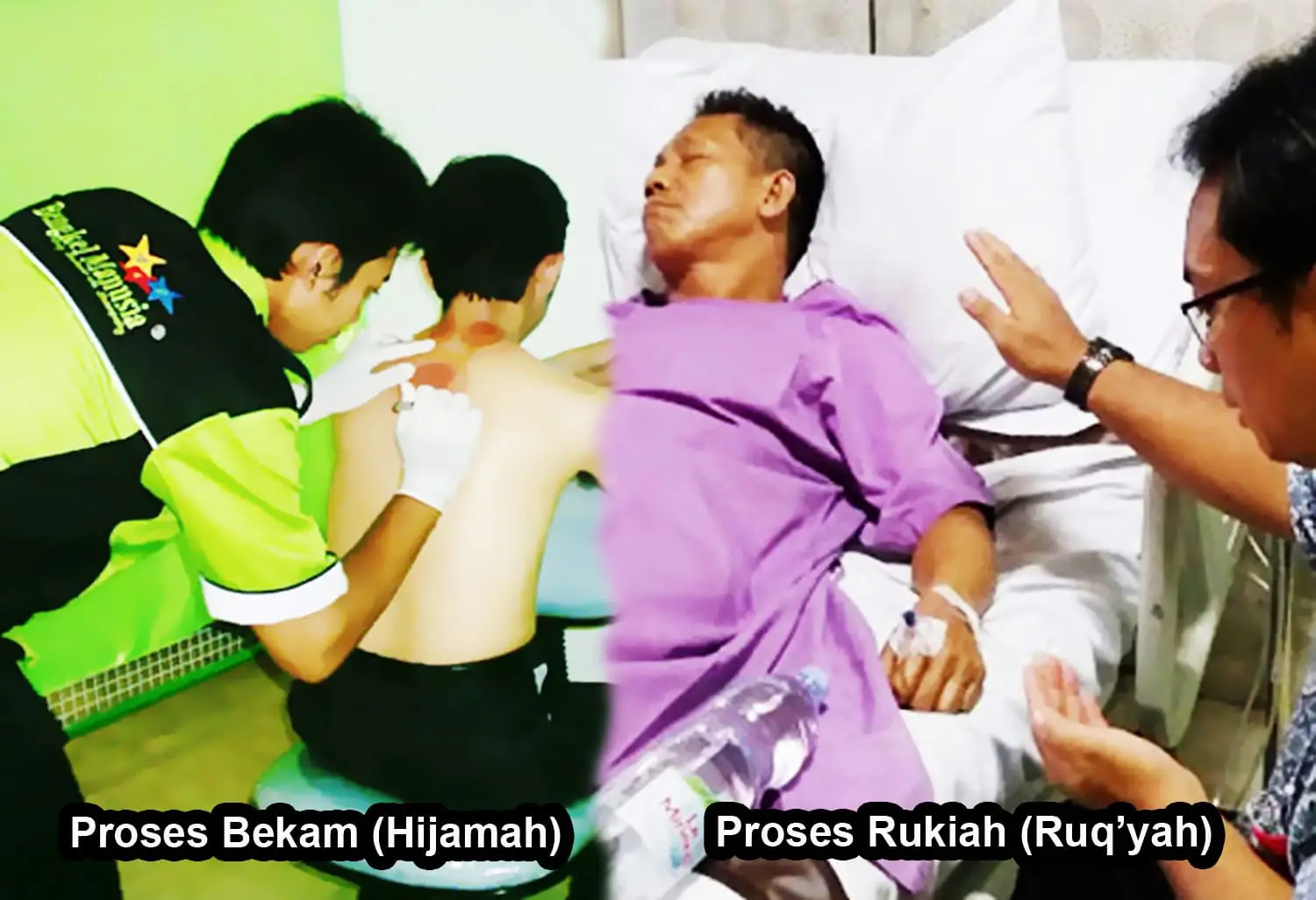 Mengapa Biaya Bekam dan Ruqyah di Bengkel Manusia Beda?